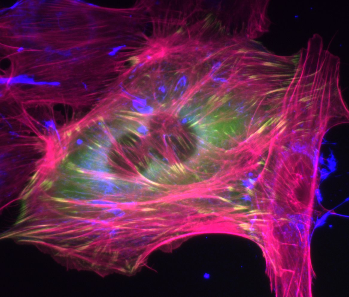 Cell Image Feature Cell Images – Morgan Lab