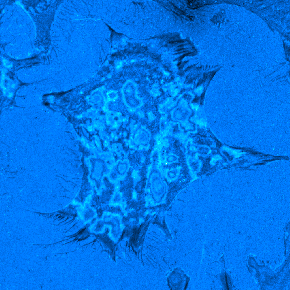 IRMMov01FFSubCyanHot