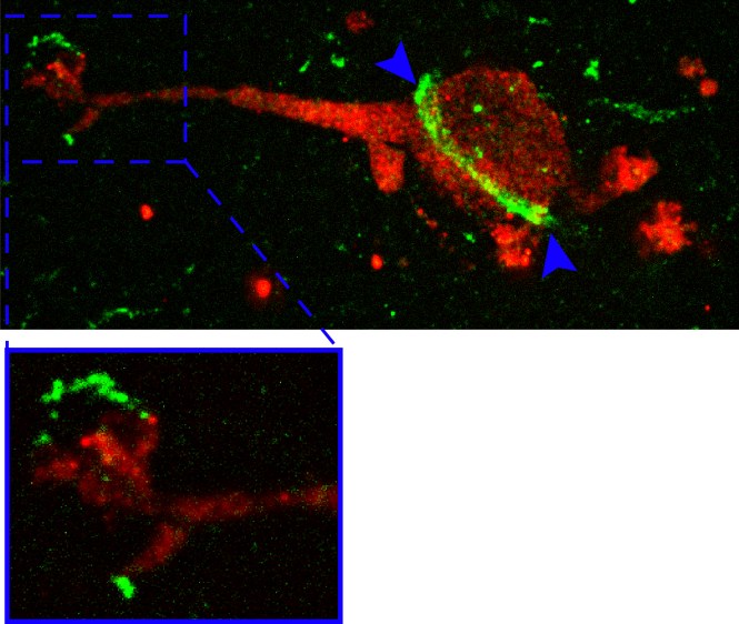 MRM_MRC_PIResponse_Beta6_Localisation_20170206